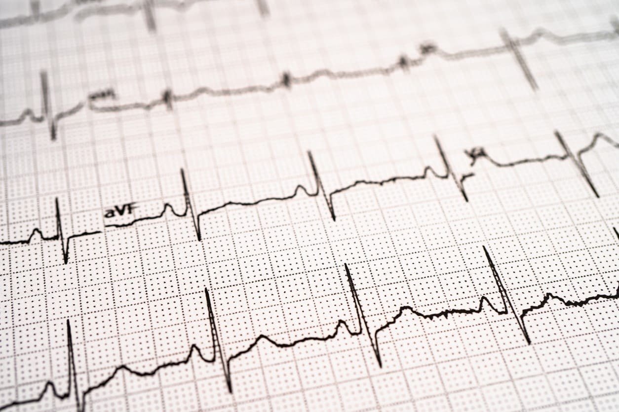 Potential of Hexarelin Peptide in Cardiovascular Health