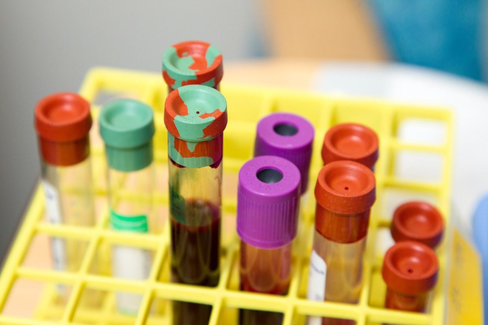MGF Peptide Splicing May Help Maximize Gains - Core Pep